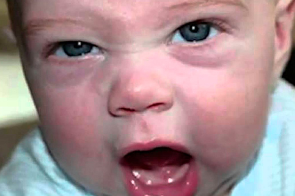 Bébés en colère